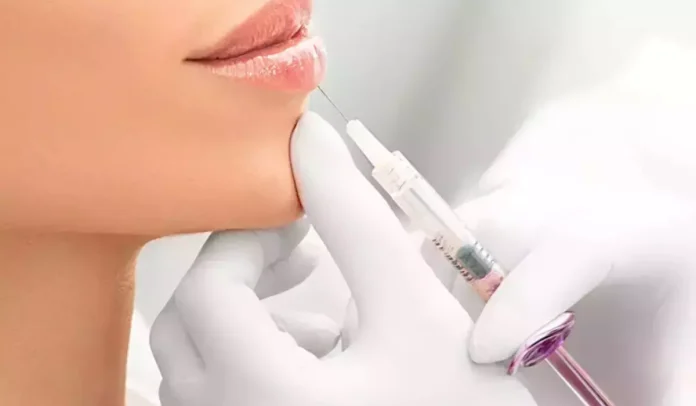 hialuronic buze